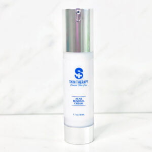 Acne Renewal Cream